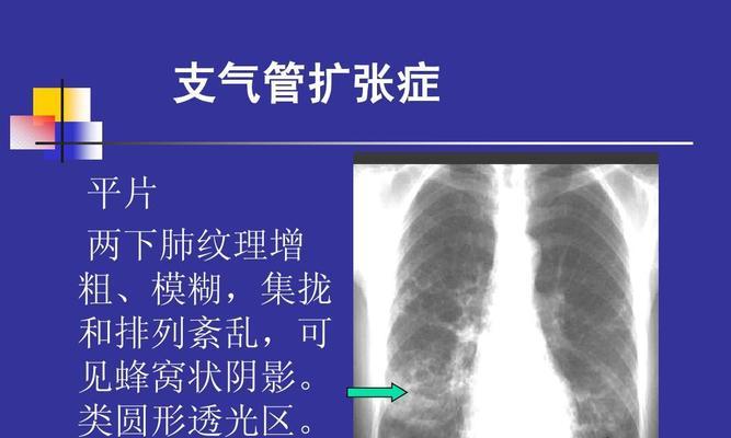 《人体工厂肺部循环通关指南》（以游戏为主的肺部循环通关技巧）